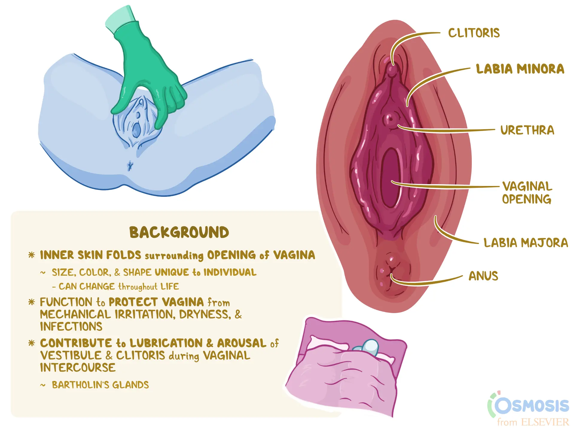 An infographic detailing the causes, signs and symptoms, diagnosis, and treatment of Labia Minora